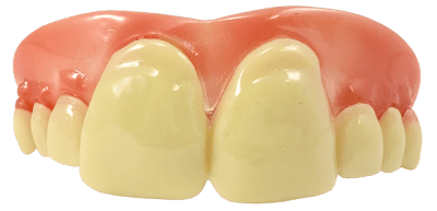 Megabucks tænder
